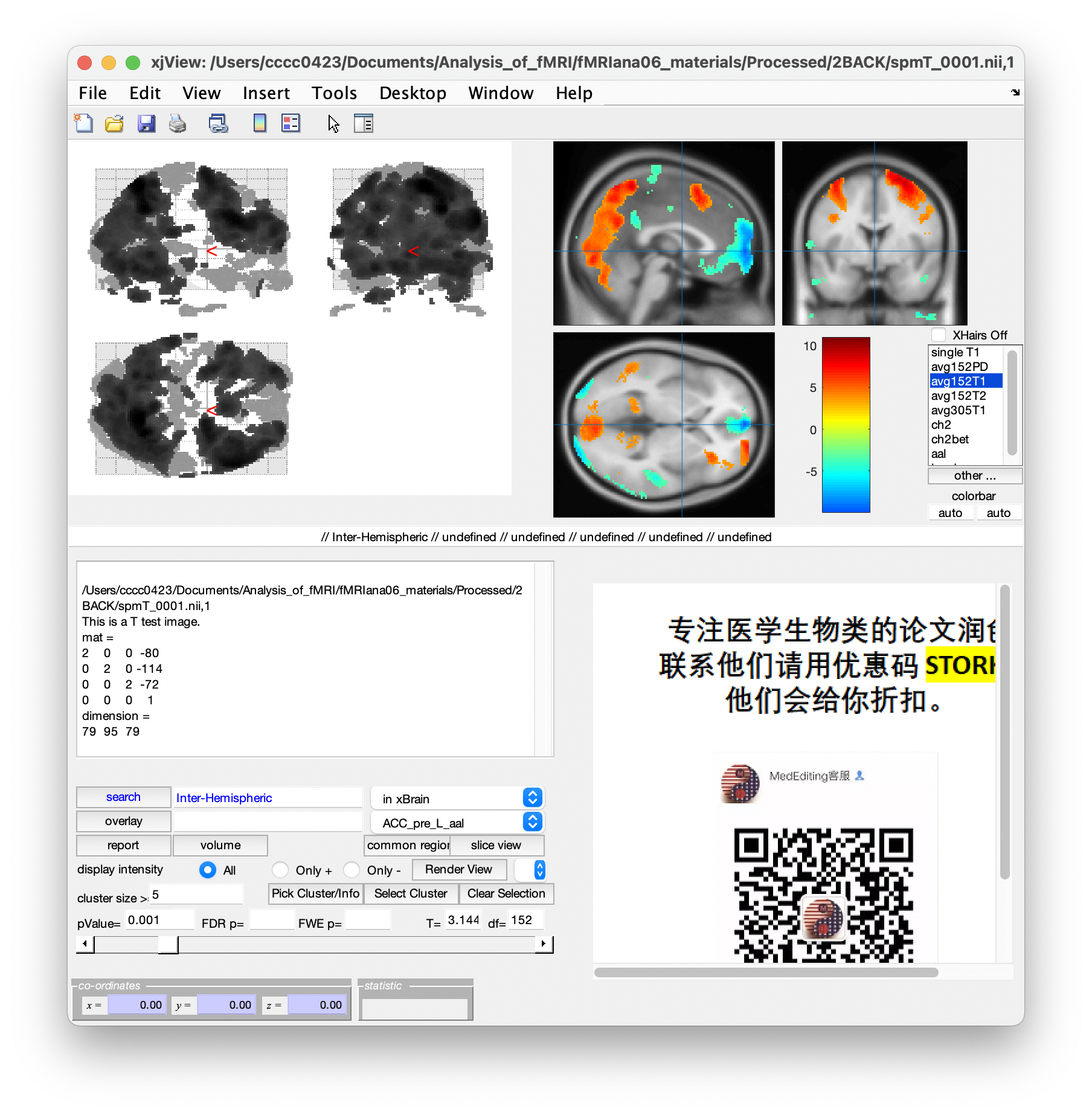 以 xjView 開啟影像檔。