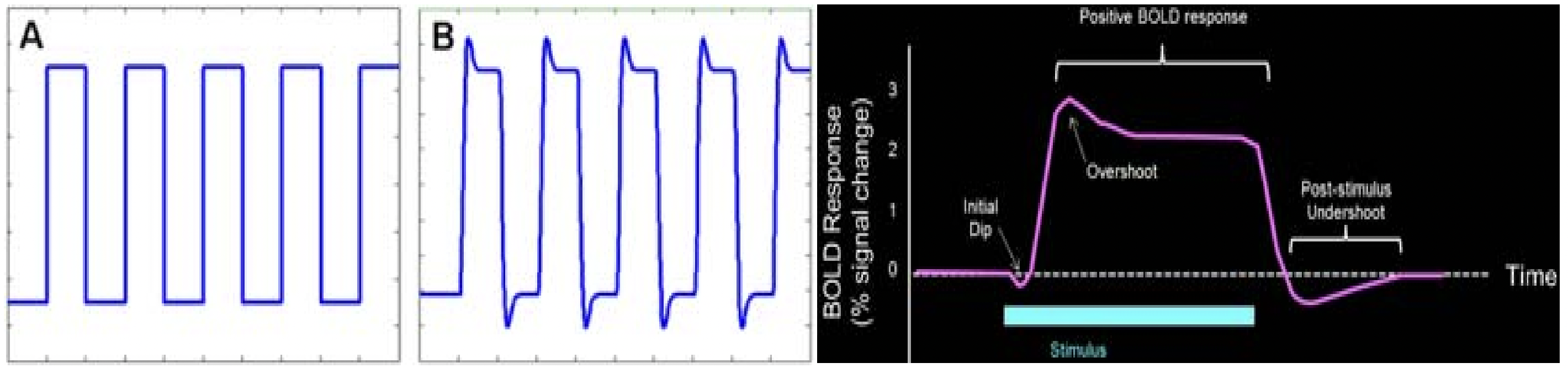 Block design. 圖源:Matthijs Vink, *Preprocessing and analysis of functional MRI data*, 2007.