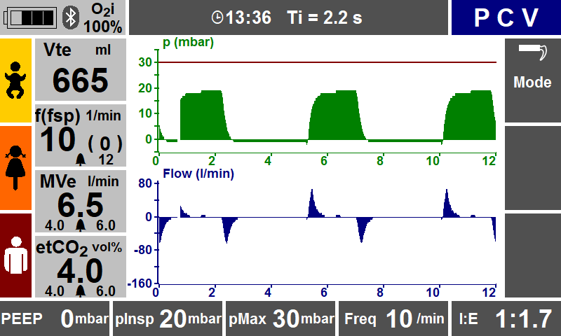 Pressure Controlled Ventilation