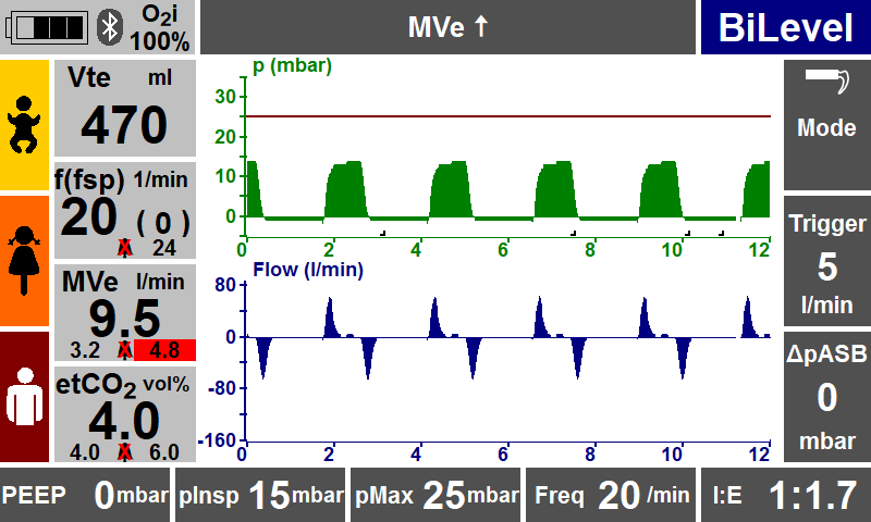 BiLevel + ASB