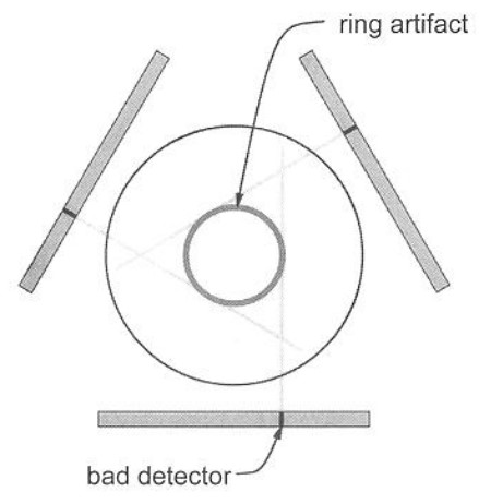 An Example of a Ring Artifact