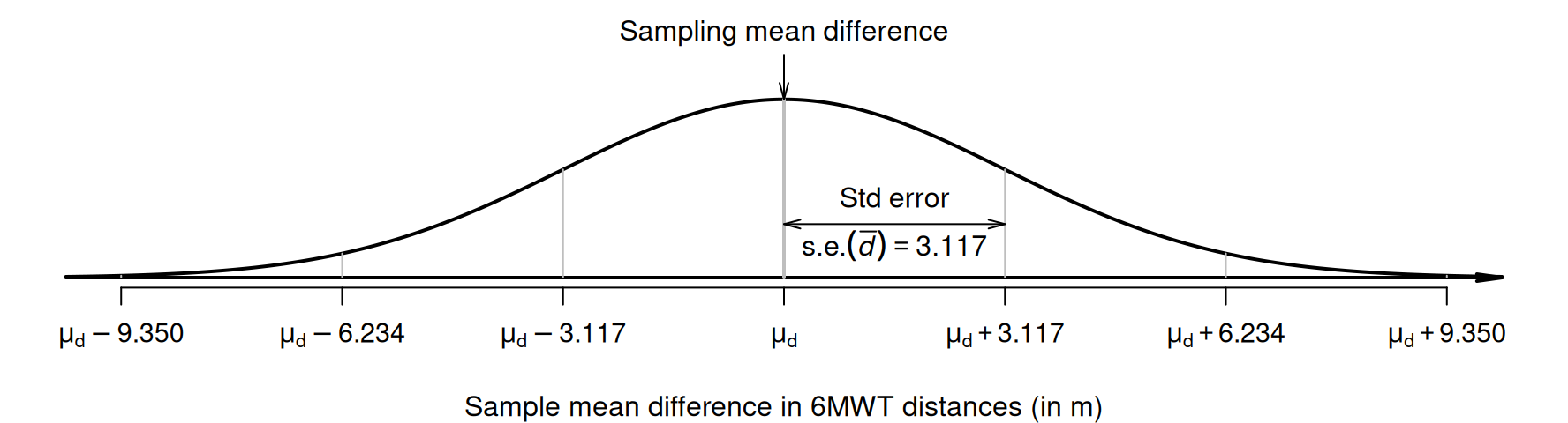 The sampling distribution is a normal distribution; it describes how the sample mean difference between the 6MWT distances varies in samples of size $n = 50$.